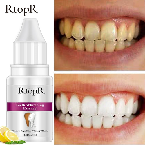 Top Teeth Whitening Essence